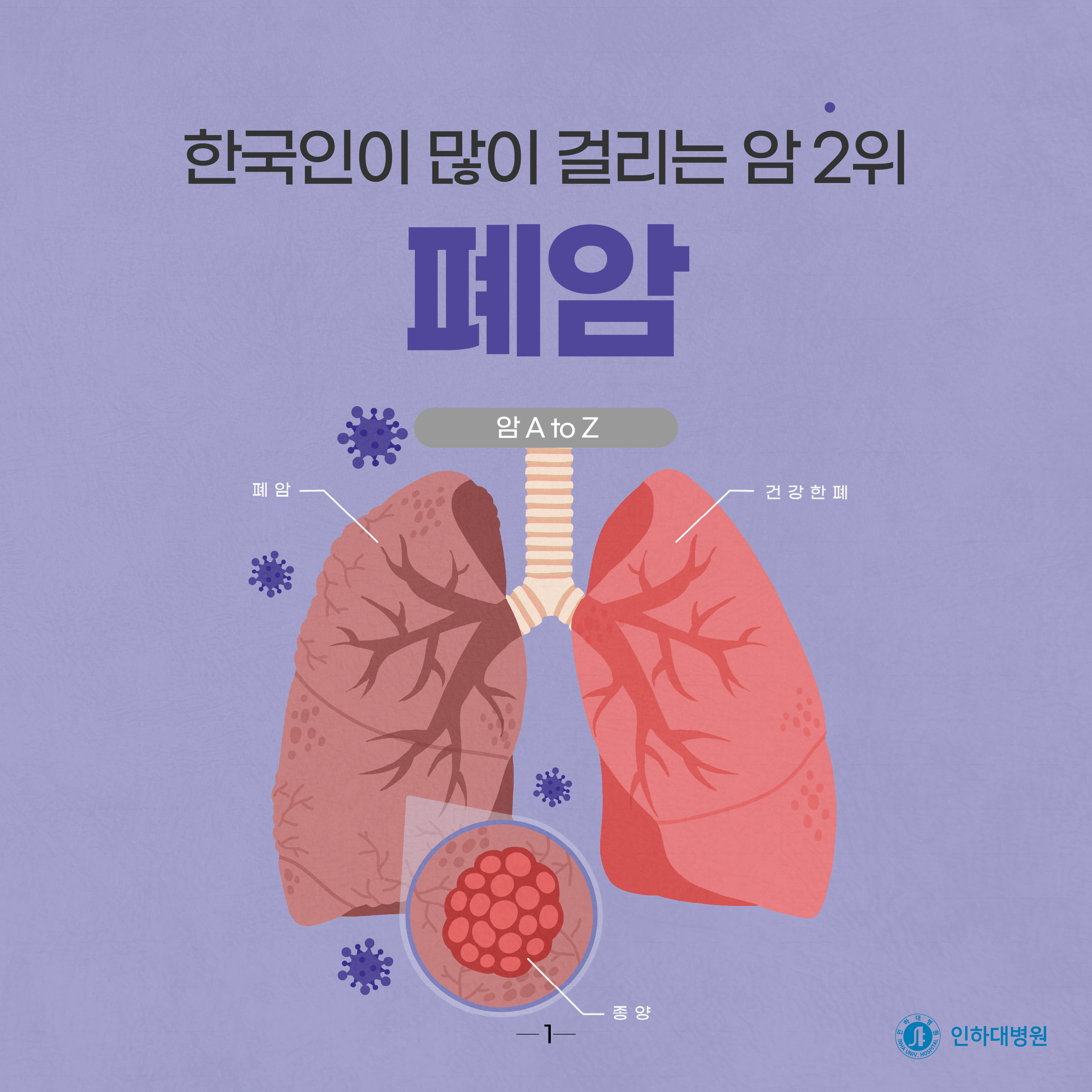 [건강의학정보] 한국인이 많이 걸리는 암 2위, 폐암