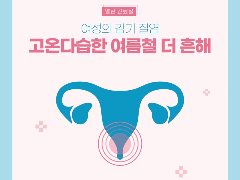 [열린 진료실] 고온다습한 여름, 증가하는 질염