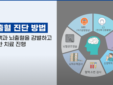 뇌출혈 진단 - 뇌출혈 바로 알기