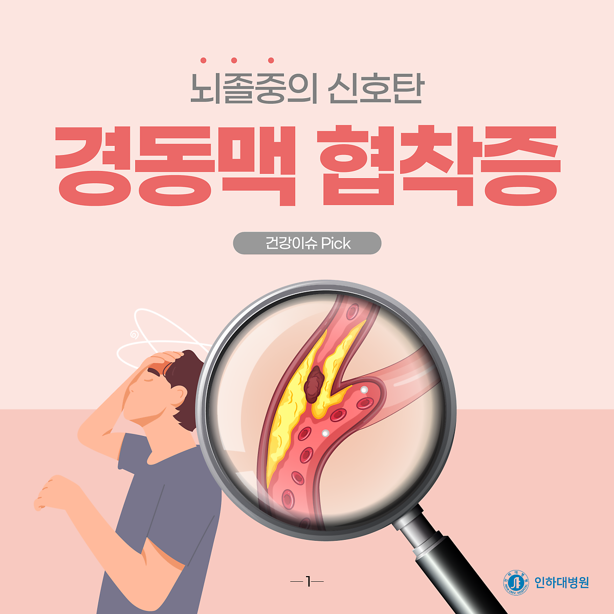[건강의학정보] 뇌졸중의 신호탄, 경동맥 협착증