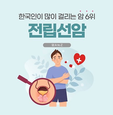 [건강의학정보] 한국인이 많이 걸리는 암 6위 '전립선암'