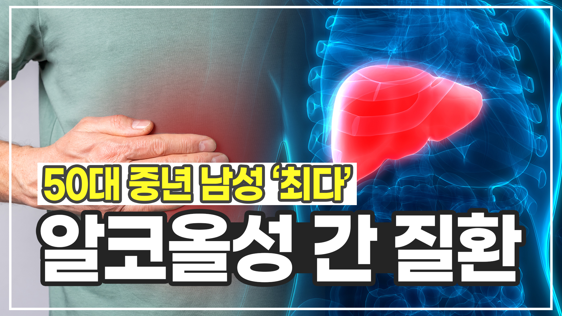 [건강드림] 50대 중년 남성 '최다' 알코올성 간 질환의 모든 것!