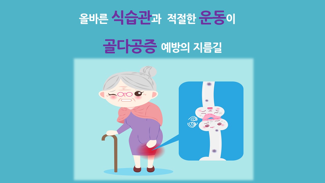 [의학칼럼] 올바른 식습관과 적절한 운동이 골다공증 예방의 지름길