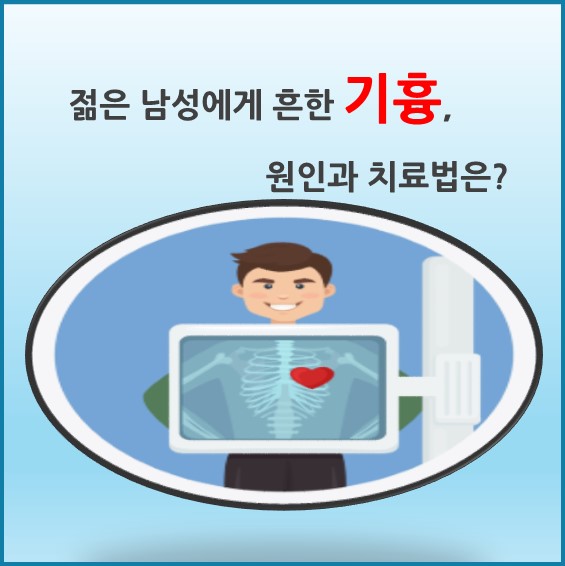 [의학칼럼] 젊은 남성에게 흔한 기흉, 원인과 치료법은?