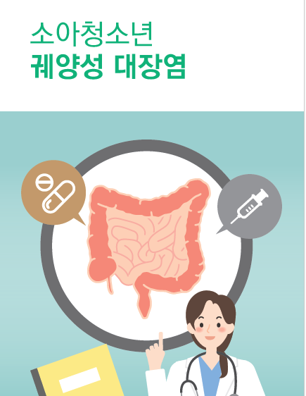 궤양성 대장염