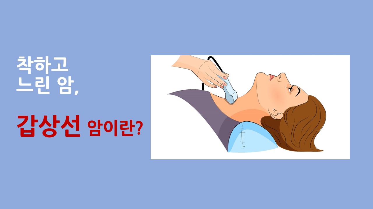 [의학칼럼] 착하고 느린 암, 갑상선 암이란?
