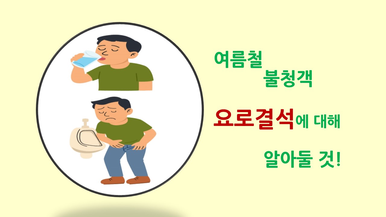 [의학칼럼] 여름철 불청객 요로결석에 대해 알아둘 것!