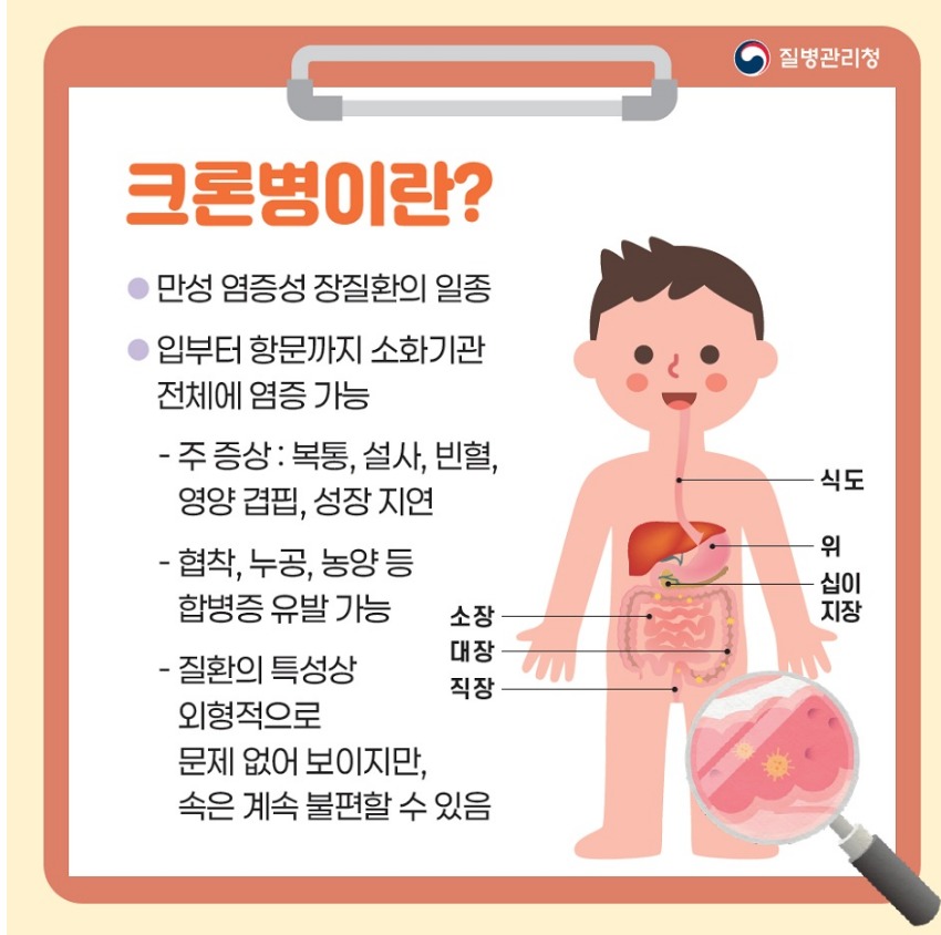 [질병관리청 제작 및 배포] 교직원을 위한 소아청소년 다빈도 희귀질환 안내서-크론병