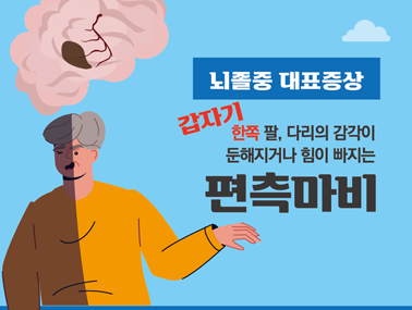 [인포그래픽] 뇌졸중 첫 번째 조기증상 편측마비
