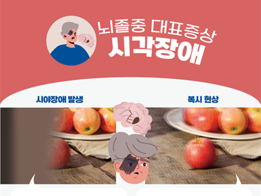 [인포그래픽] 뇌졸중 세 번째 대표증상 시각장애