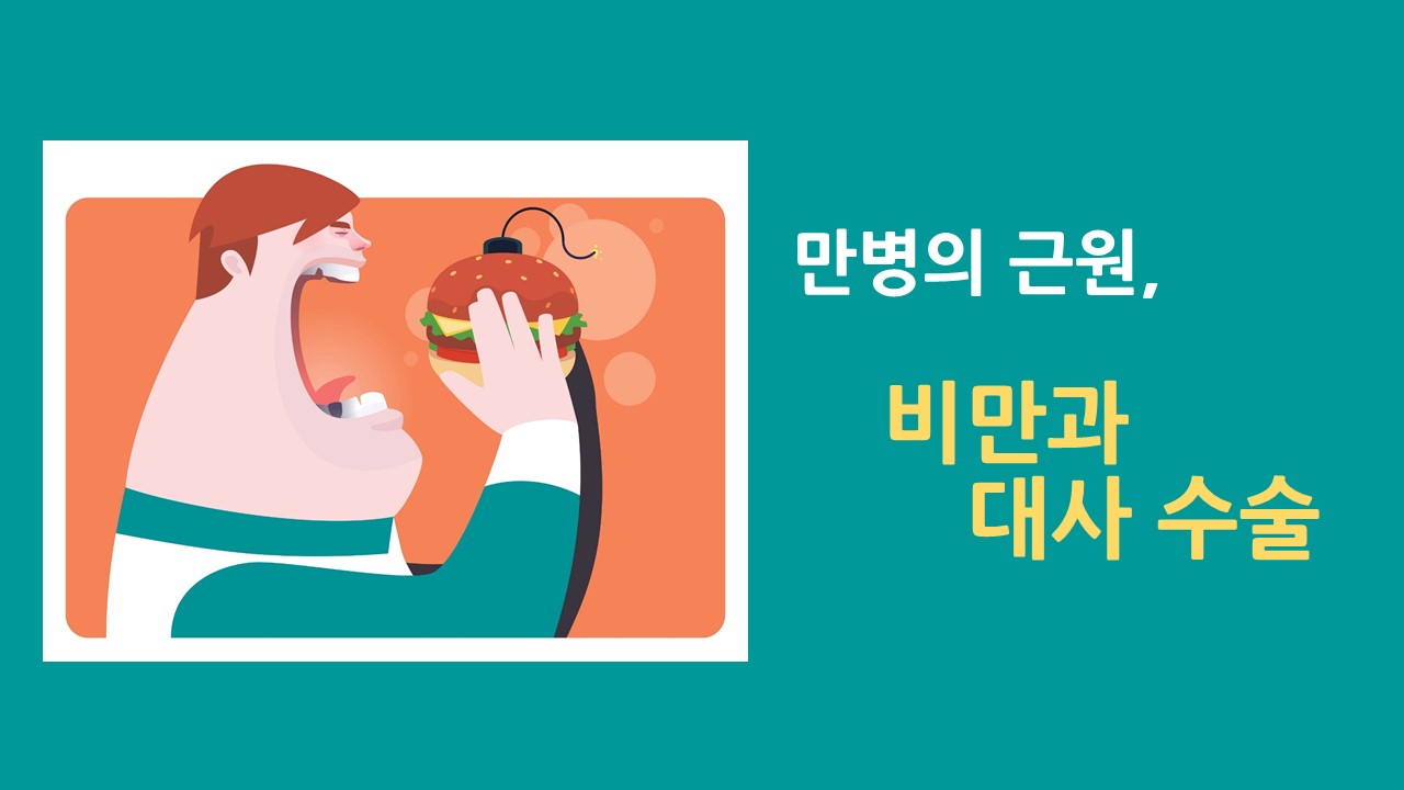 [의학칼럼] 만병의 근원, 비만과 대사 수술