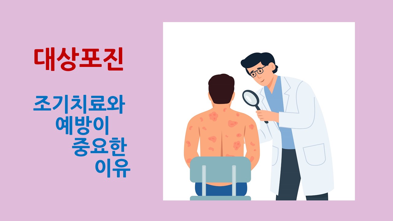 [의학칼럼] 대상포진, 조기 치료와 예방이 중요한 이유