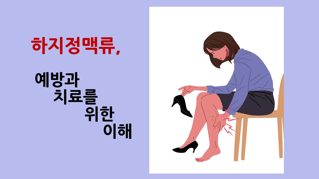 [의학칼럼] 하지정맥류, 예방과 치료를 위한 이해