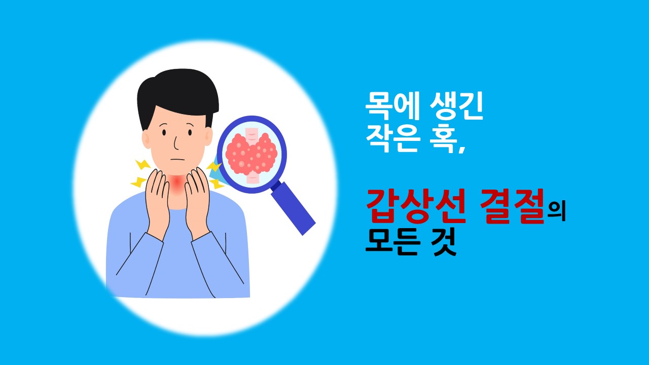 [의학칼럼] 목에 생긴 작은 혹, 갑상선 결절의 모든 것