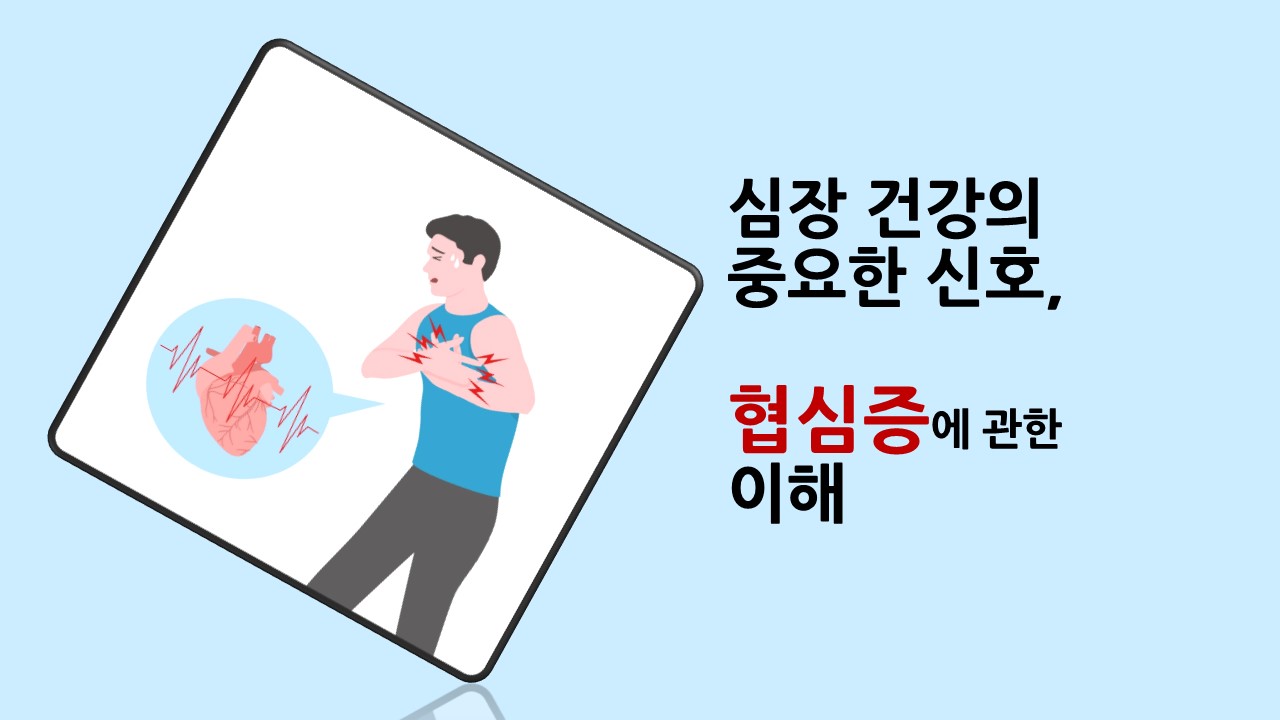 [의학칼럼] 심장 건강의 중요한 신호, 협심증에 관한 이해