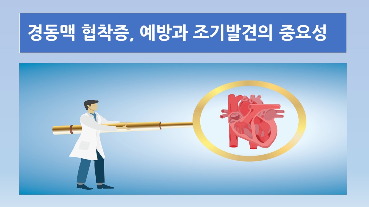 [의학칼럼] 경동맥 협착증, 예방과 조기 발견의 중요성