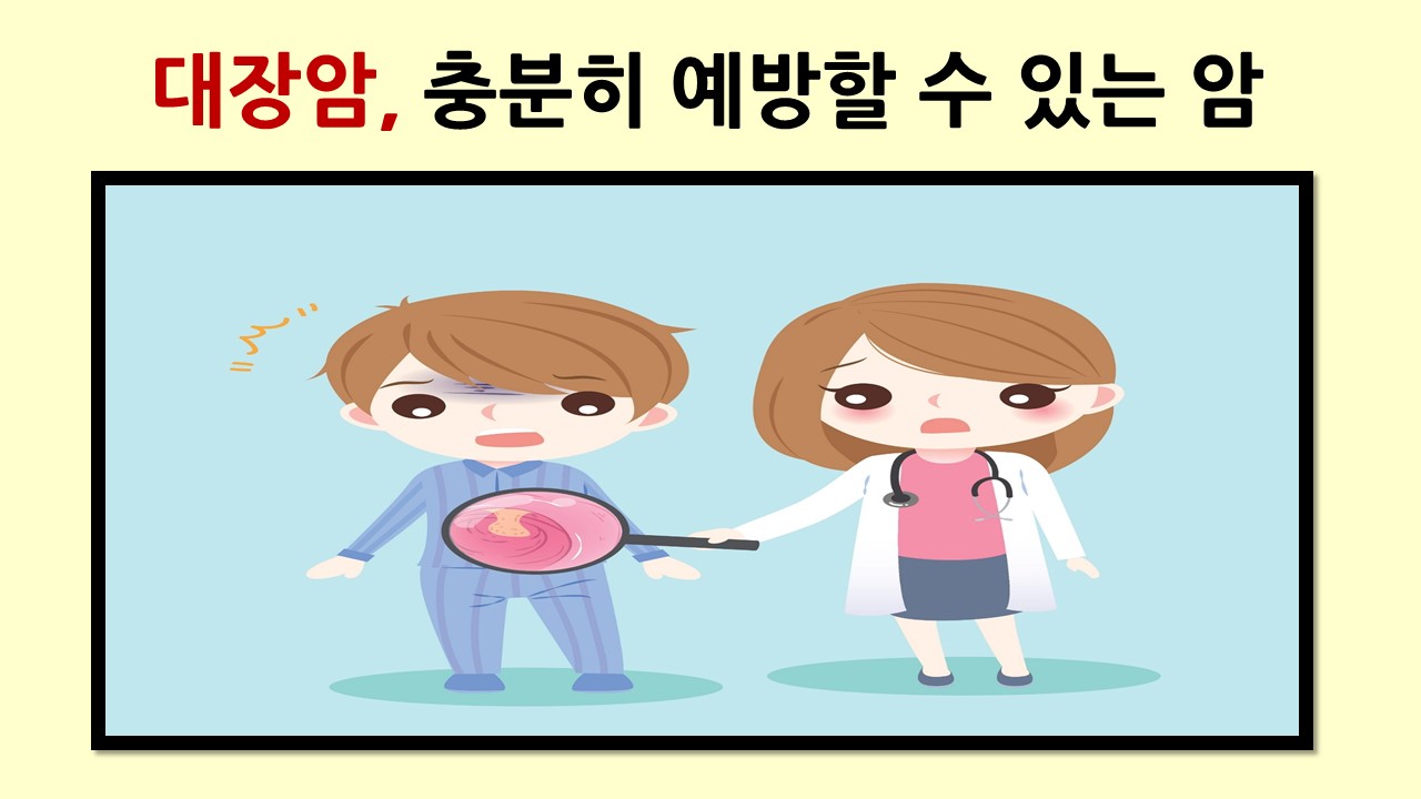 [의학칼럼] 대장암, 충분히 예방할 수 있는 암