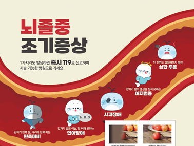 [인포그래픽] 뇌졸중 조기증상과 위험요인