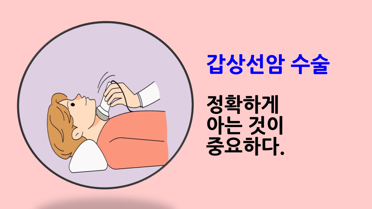[의학칼럼] 갑상선암 수술, 정확하게 아는 것이 중요하다.